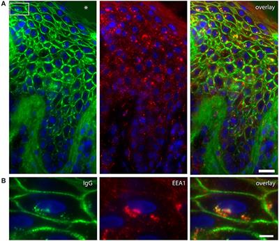 Endocytosis of IgG, Desmoglein 1, and Plakoglobin in Pemphigus Foliaceus Patient Skin